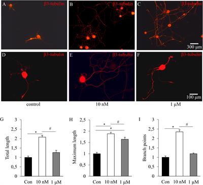 Insulin Confers Differing Effects on Neurite Outgrowth in Separate Populations of Cultured Dorsal Root Ganglion Neurons: The Role of the Insulin Receptor